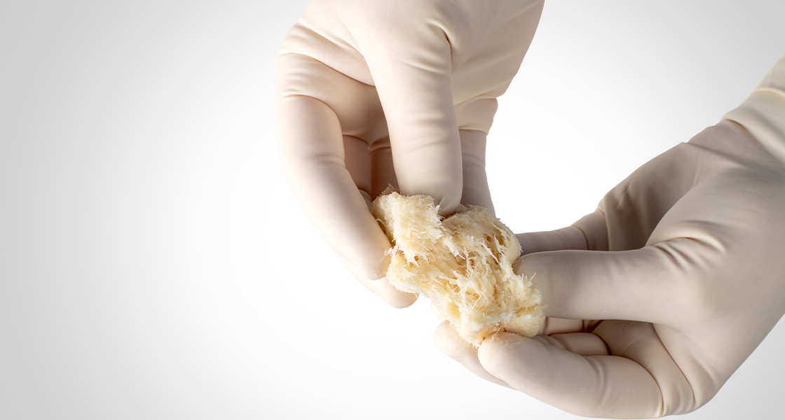 Surgeon-led bone biologics education symposium for spinal fusion — Orthofix biologics clinical evidence review