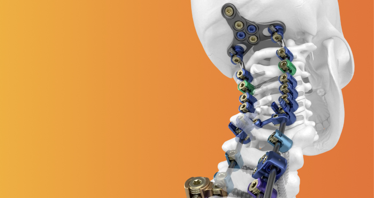 Orthofix Spinal Solutions — anterior cervical fixation, lumbar interbody fusion, and vertebral body replacement systems